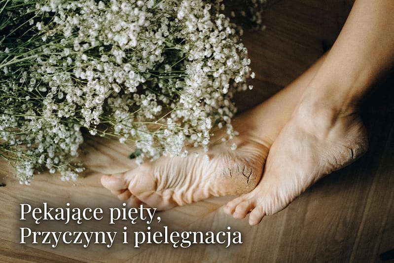 Pękające pięty – przyczyny, pielęgnacja i kiedy szukać pomocy 1 Pękające pięty – przyczyny, pielęgnacja i kiedy szukać pomocy
